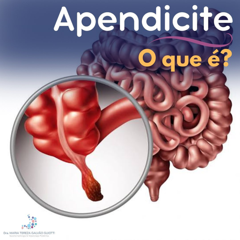 Apendicite o que é? - Dra. Maria Tereza Pediatra - Gastroenterologia e ...
