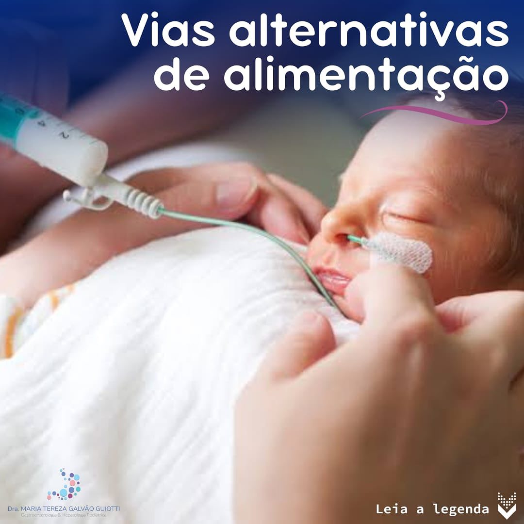 Vias alternativas para alimentacao pop pediatria dra maria tereza gastropediatria gastro hepato pediatria pinheiros sao paulo suporte nutricional fornecimento via oral