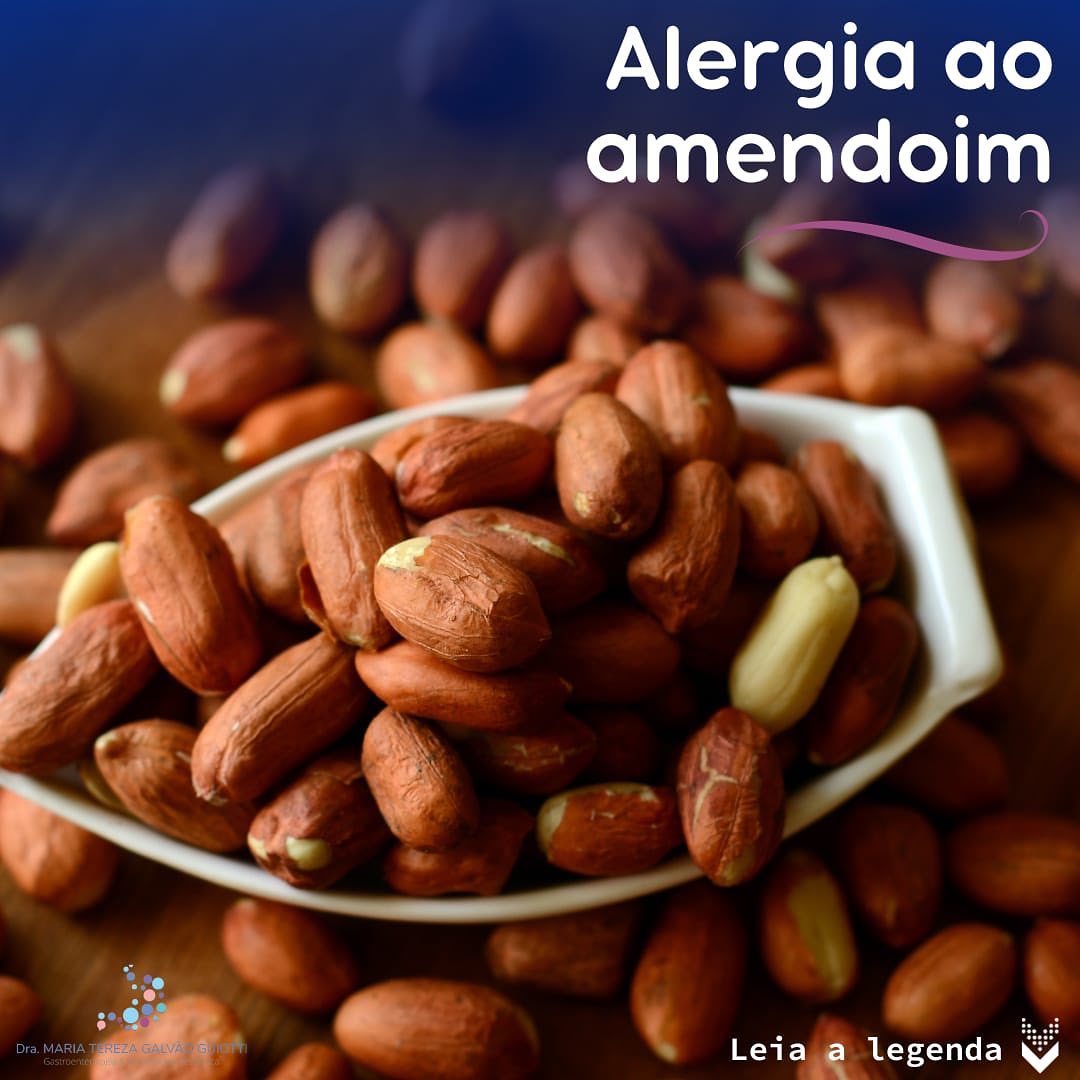Alergia ao amendoim, pop pediatria, dra maria tereza, gastropediatria, gastro, hepato, pediatria, pinheiros, são paulo, alergiam, amendoim, sintomas, ingestão, reações, tolerancias