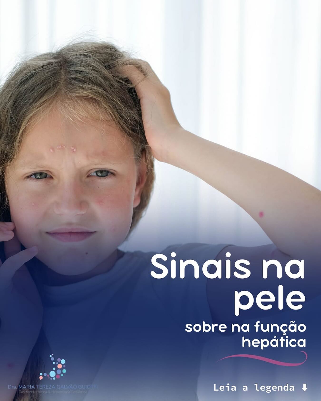 Sinais na pele sobre na função hepática